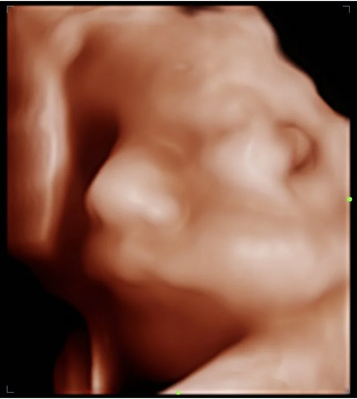 202605111909390082OB.jpg