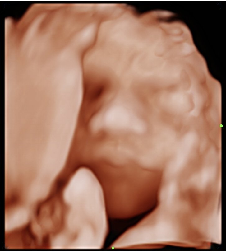 202605111843410046OB.jpg