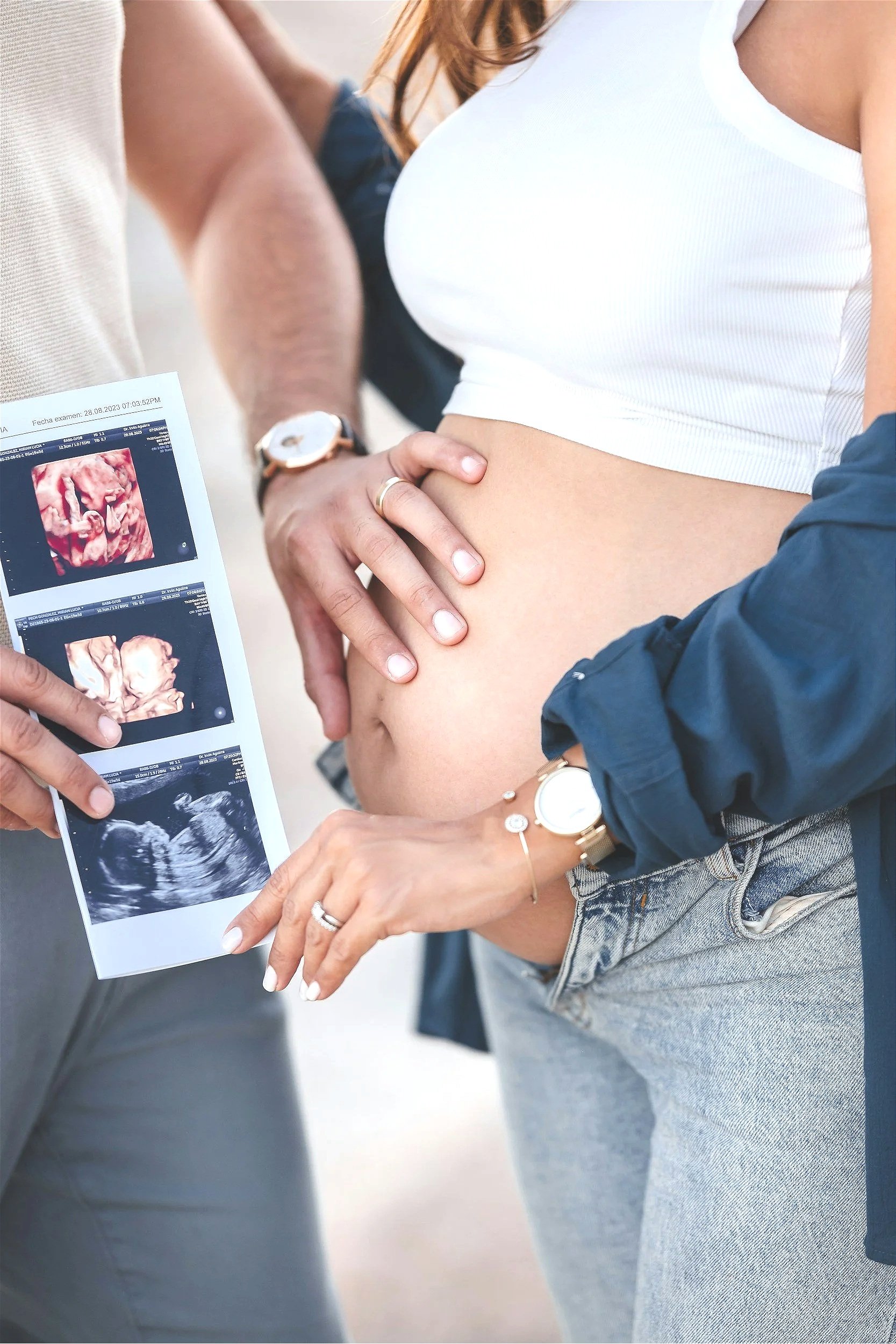 Expecting family holding ultrasound photo during a 3D/4D ultrasound session in Houston, Texas.