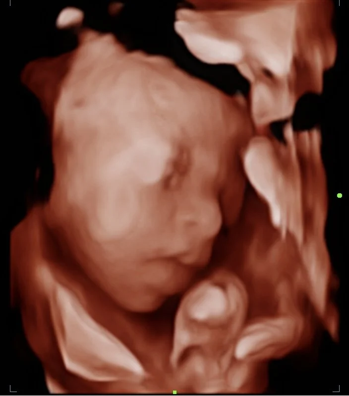 202512121405360037OB.jpg