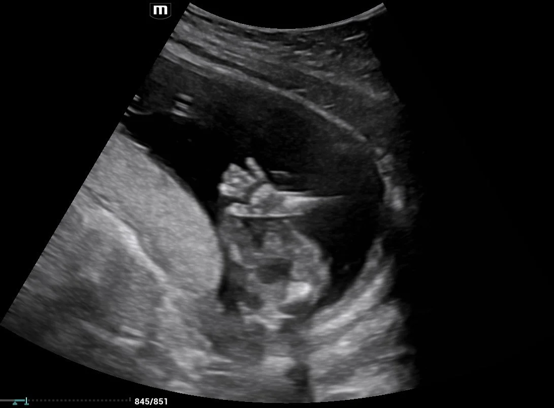 202602201041160023OB.jpg