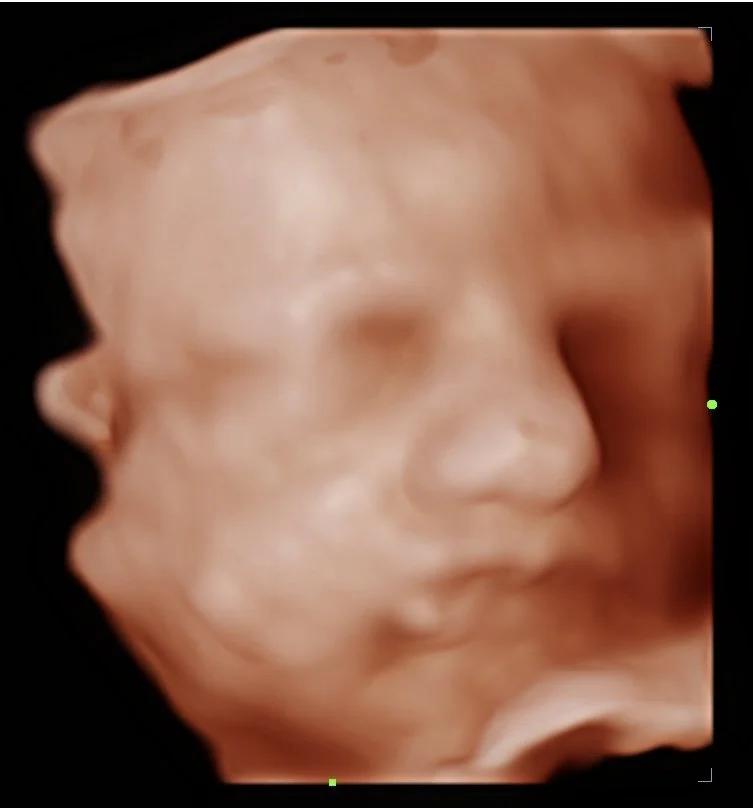 202605292044580062OB.jpg