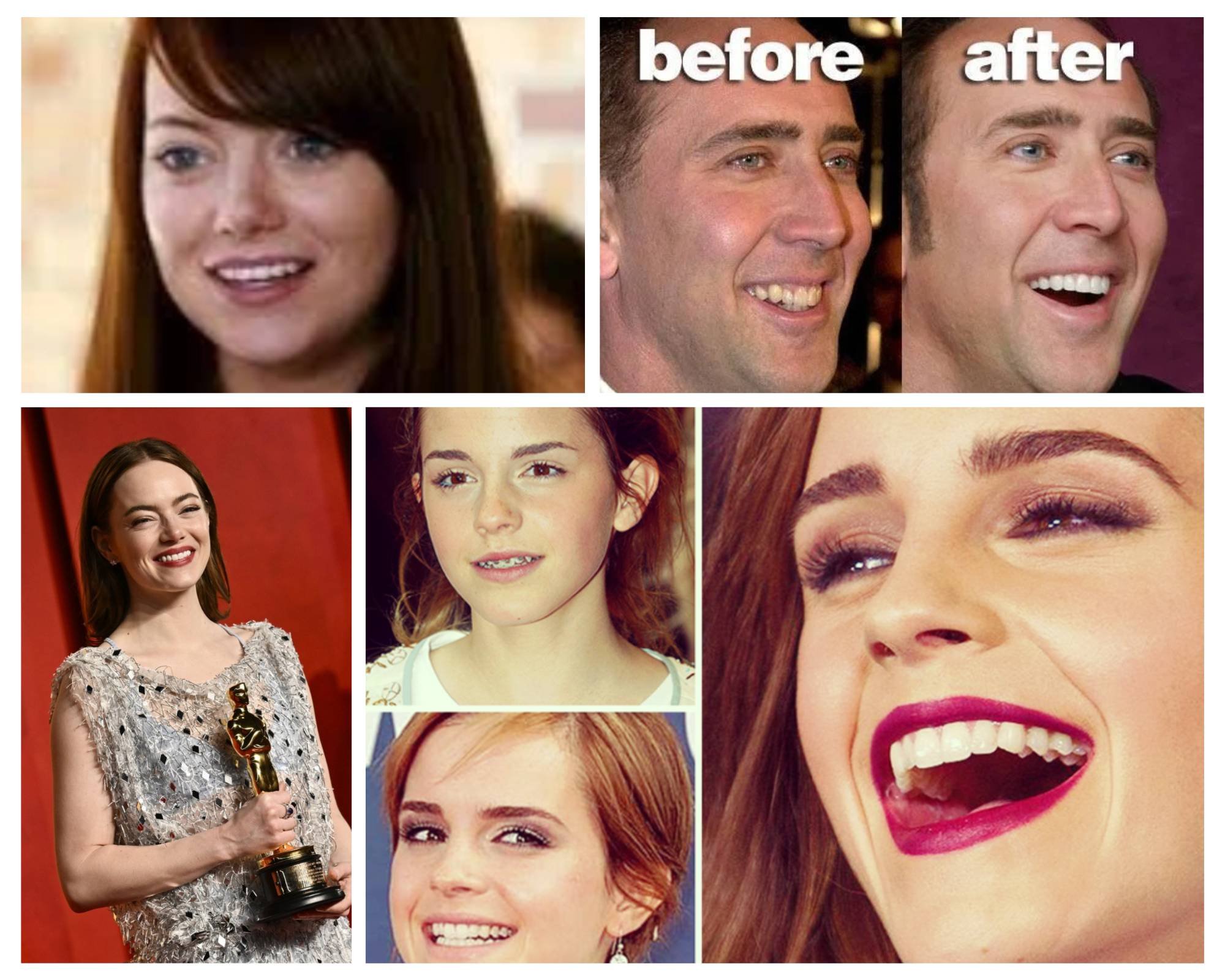We Have to Talk about Emma Stone’s Teeth