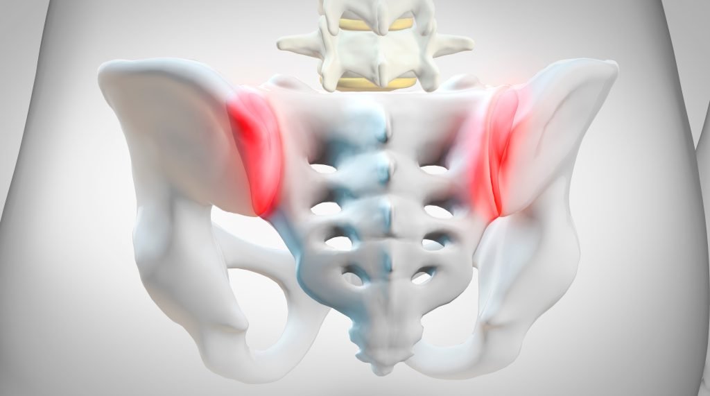 The Silent Epidemic: Understanding and Treating Sacroiliac Joint (SIJ) Dysfunction