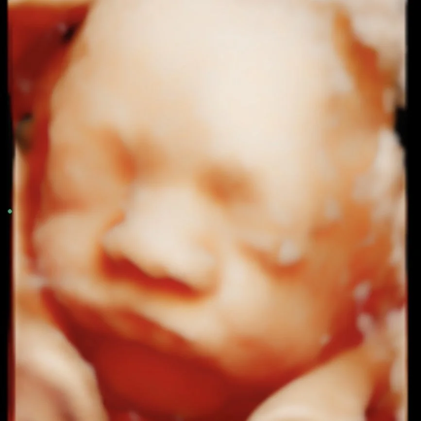 5D Baby ultrasound Perth