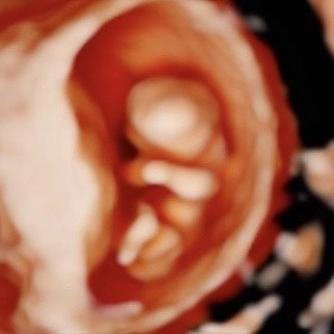 Close-up of a person's mouth with teeth visible, possibly yawning or shouting.