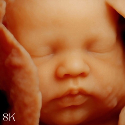33 weeks pregnant in 5D baby ultrasound to 8K