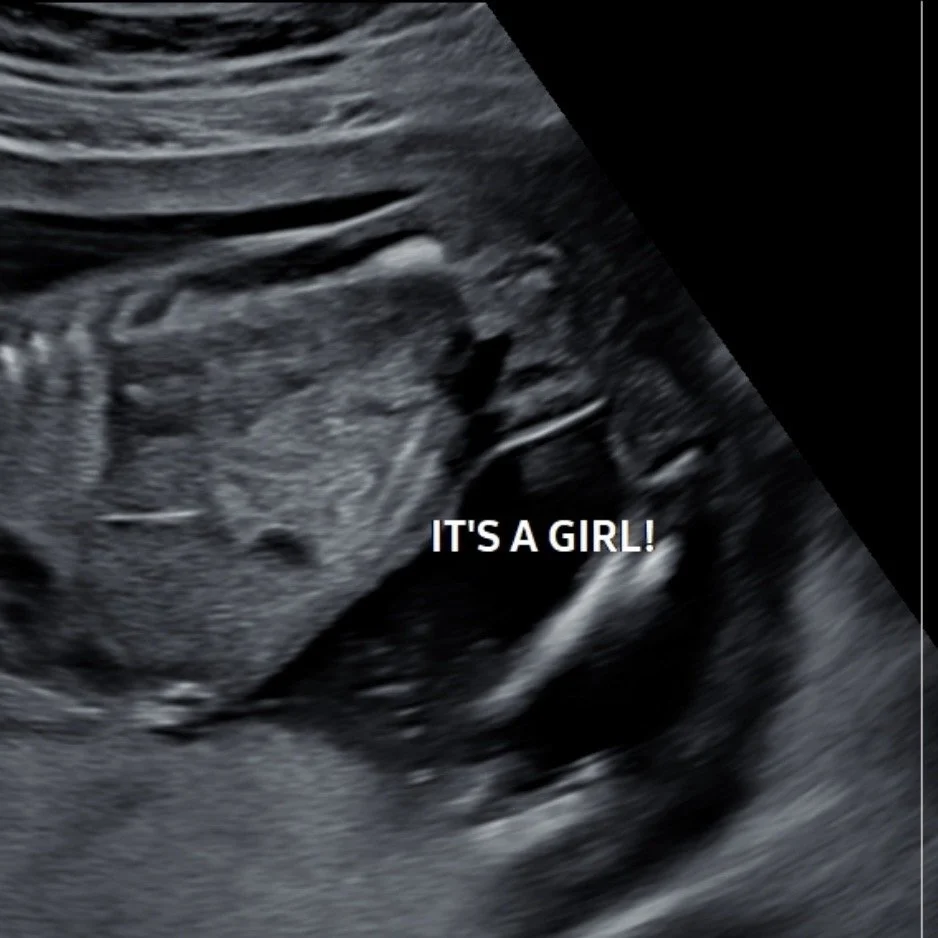 Ultrasound image of a fetus with text overlay that says 'It's a girl!'