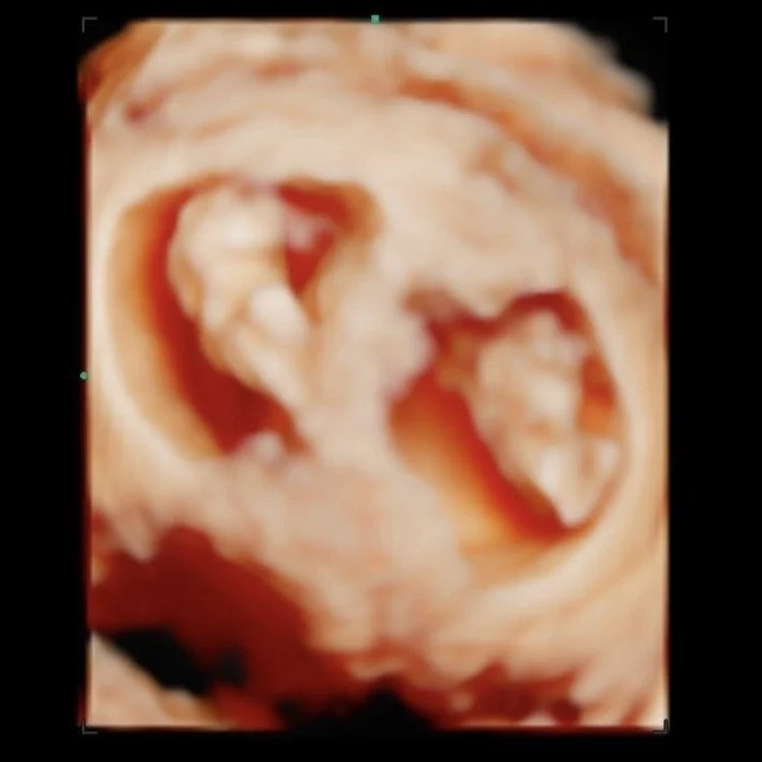 Close-up of a raw piece of meat, possibly bacon or pork.