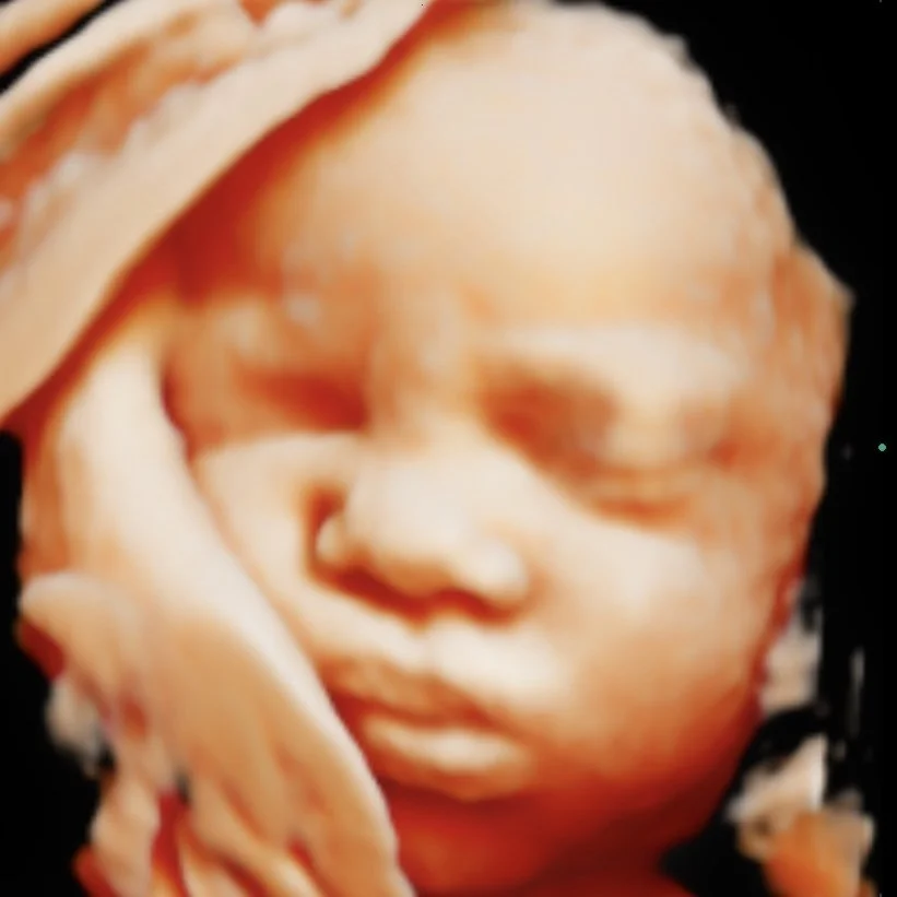Close-up of a baby's face with eyes closed, resting peacefully, with a hand gently touching the face.