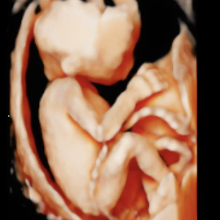 Close-up of a human fetus in the womb.