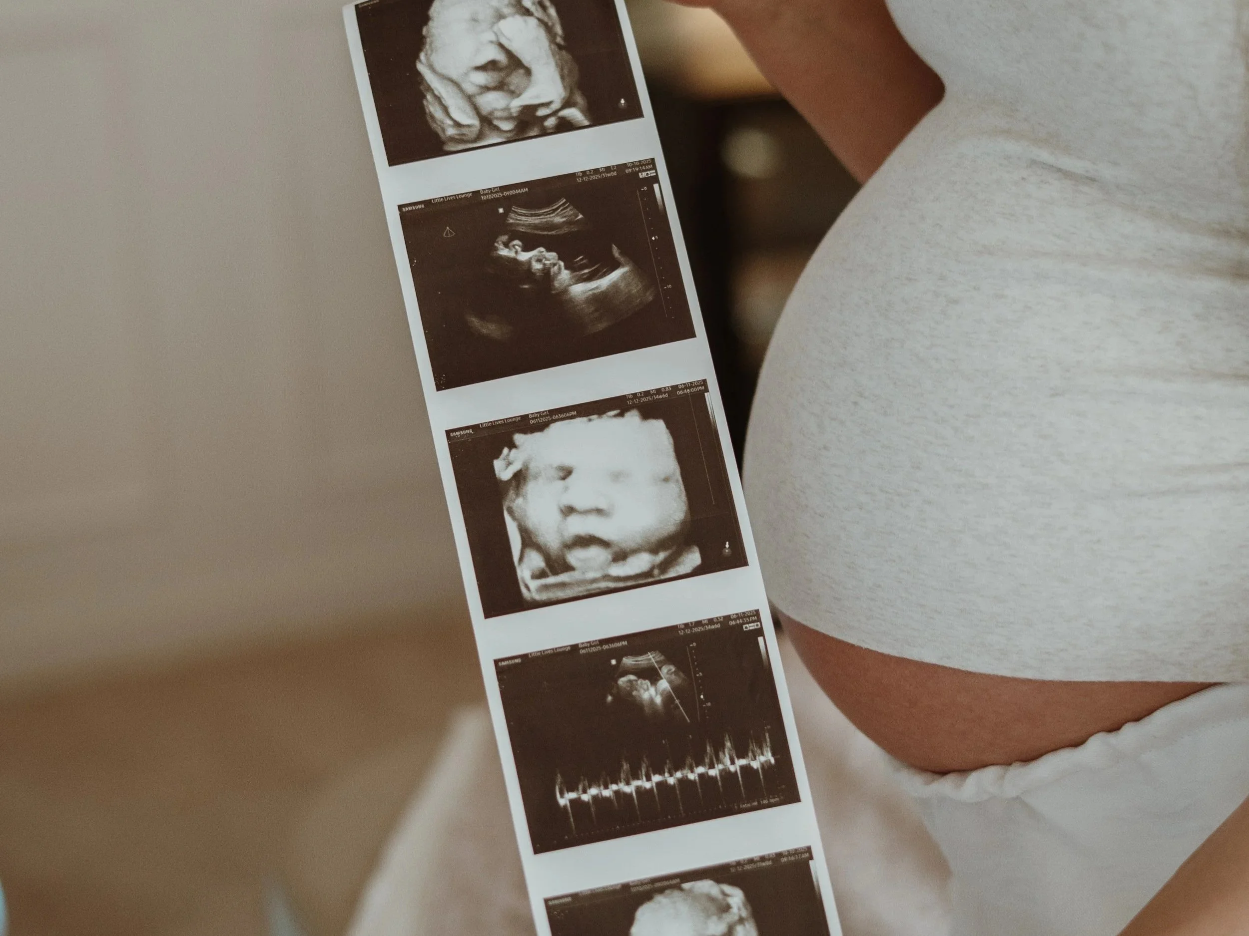 Pregnancy announcement ultrasound thermal photo strip