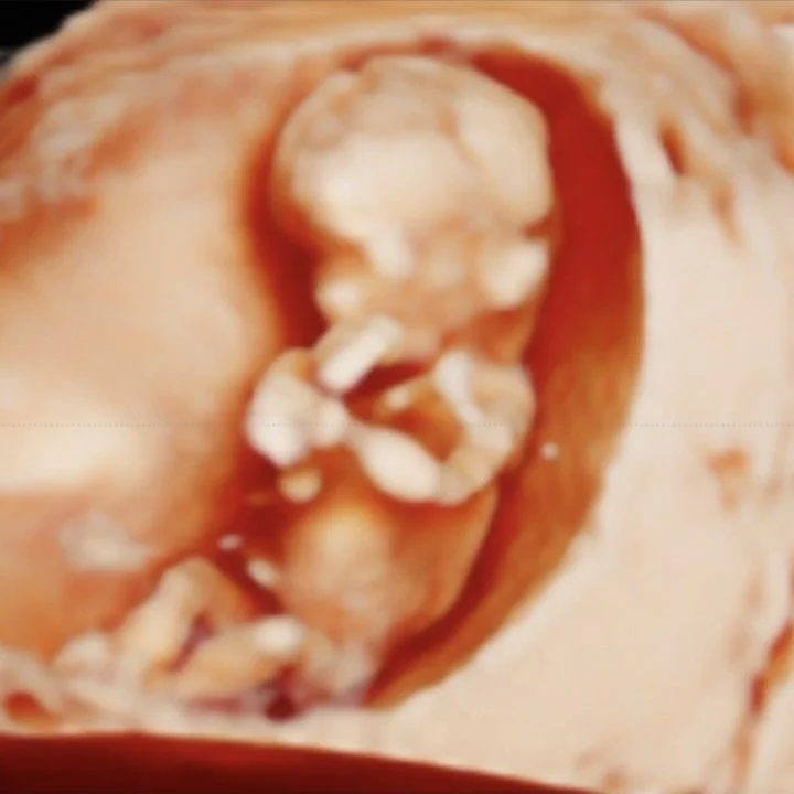11 weeks pregnant in 5D