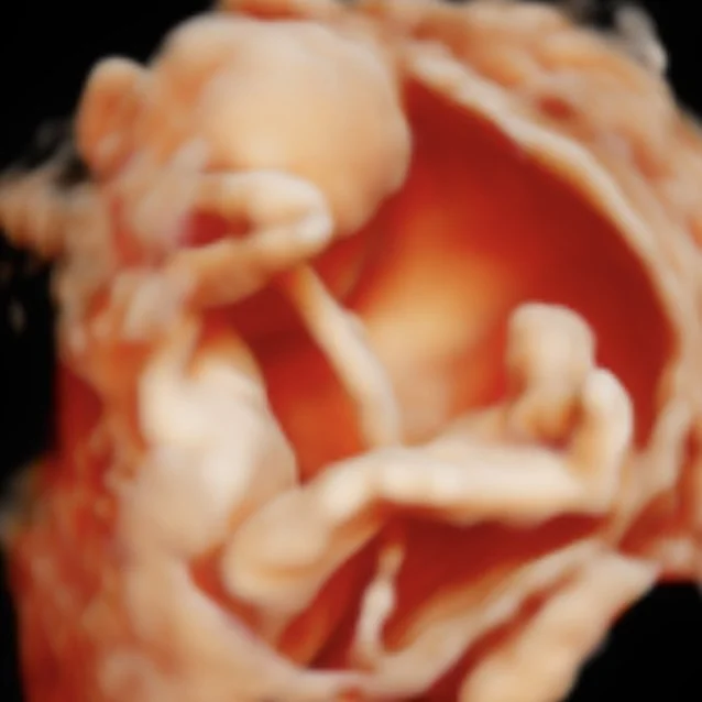 Close-up of a cooked shrimp with curled tail, pink and white flesh, and a black background.