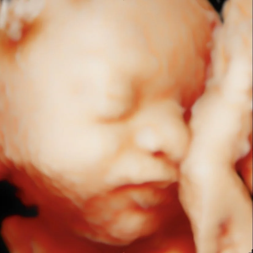 Close-up of a sleeping baby's face with one hand near the cheek.
