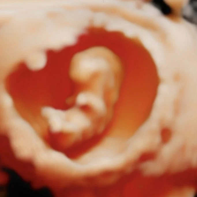 9 weeks pregnant Baby in 5D