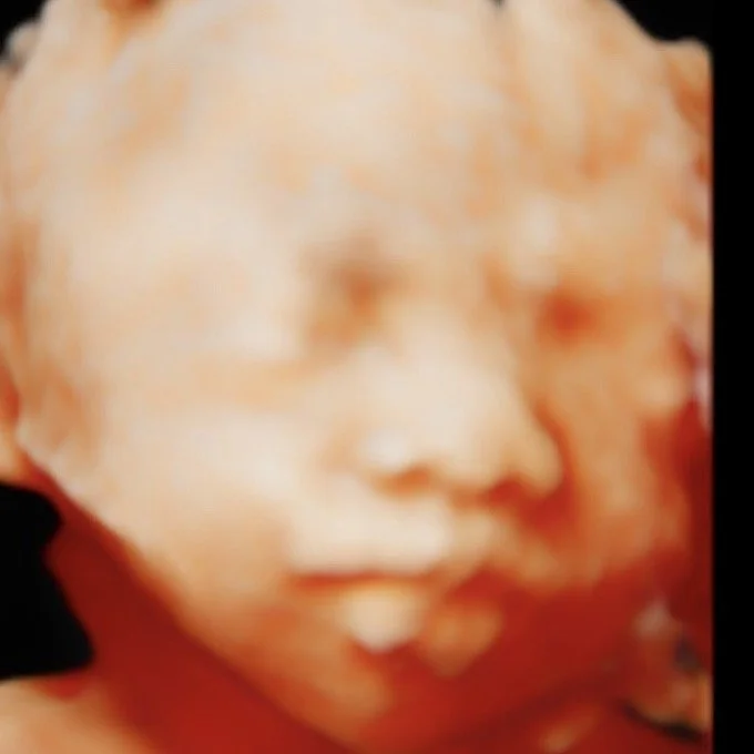 Close-up of a baby's face with eyes closed, showing a peaceful expression.