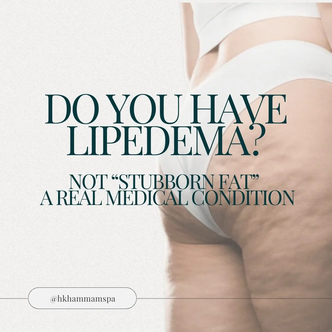 Lipedema is a chronic condition tied to the lymphatic system, not simply excess fat. It frequently includes symptoms like pain, inflammation, and fluid retention. 

Though not a cure, ongoing lymphatic drainage can help manage symptoms by promoting c