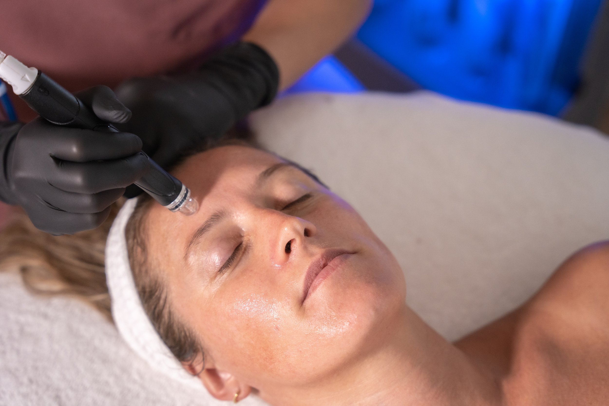 A woman lying down with her eyes closed receiving a cosmetic treatment on her forehead using a pen-like device from a professional wearing black gloves.