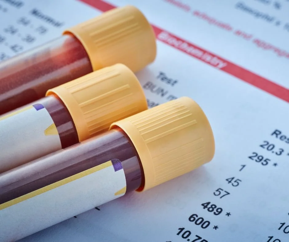 blood vials lab test results
