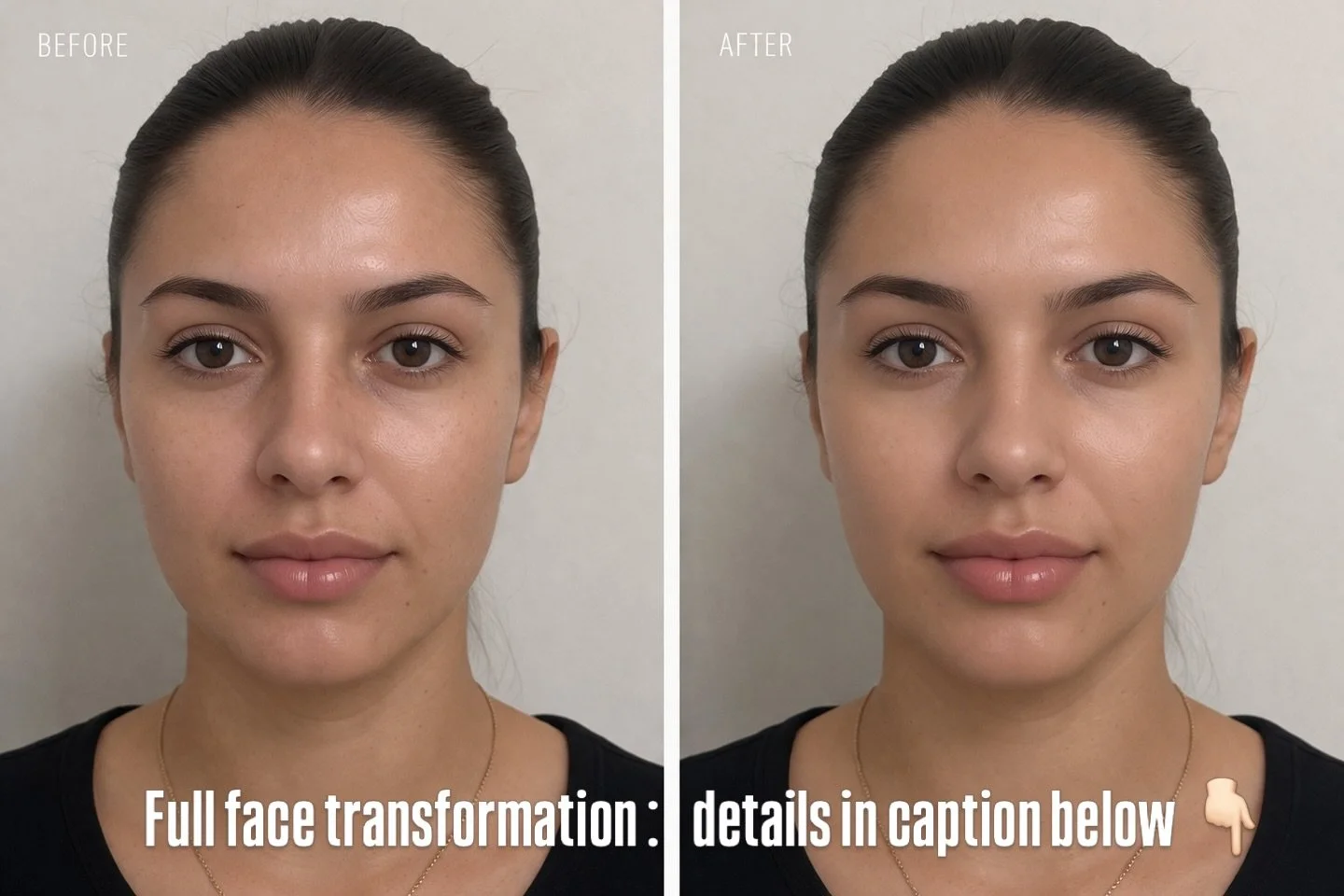 April Fools

She didn&rsquo;t need filler&hellip;because she is AI 💁🏻&zwj;♀️ 

And not everyone who walks in my door gets it

Not every face needs volume
Not every concern should be injected

I will tell you no
Because overfilled isn&rsquo;t a look