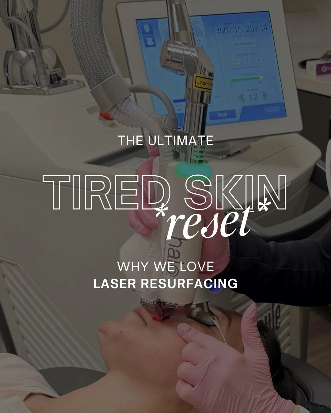 Tired skin isn&rsquo;t just about sleep
It&rsquo;s dullness, texture, and pigmentation that no skincare is fixing

This is your reset ✨

Halo laser resurfacing targets fine lines, sun damage, dark spots, and uneven tone so your skin looks smoother, c