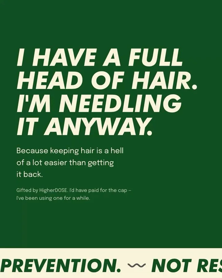 I have a full head of hair. I&rsquo;m needling it anyway.

Comment&nbsp;HAIR&nbsp;and I&rsquo;ll DM you the whole board. (Gifted by @higherdose&hellip;the cap I&rsquo;ve had for a year.)

Nobody starts a scalp routine while they still have the scalp.