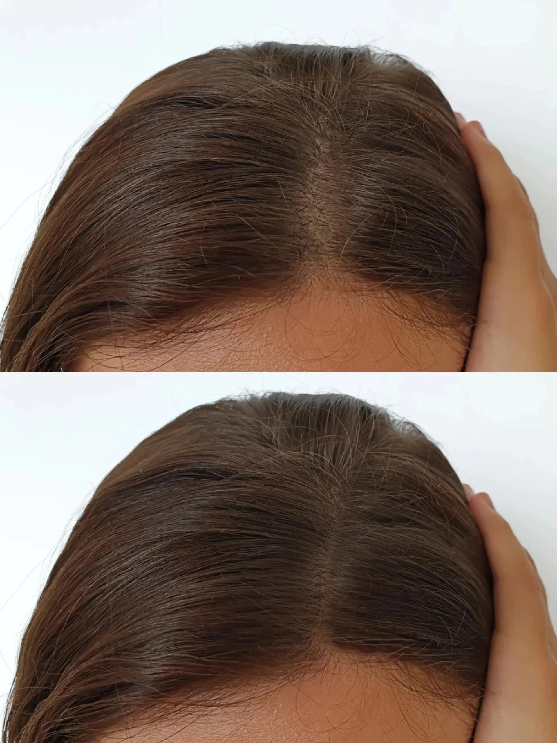Before and after images showing improved hair density at the scalp after OKAPP's cosmetic micropigmentation treatment..