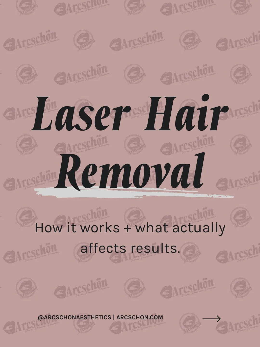 Laser Hair Removal at Arcsch&ouml;n✨ (and what actually affects results)

✅ Laser targets pigment (melanin) in the hair
That&rsquo;s why hair color + skin tone + the right settings matter.

✅ It&rsquo;s a series, not one-and-done
Hair grows in cycles