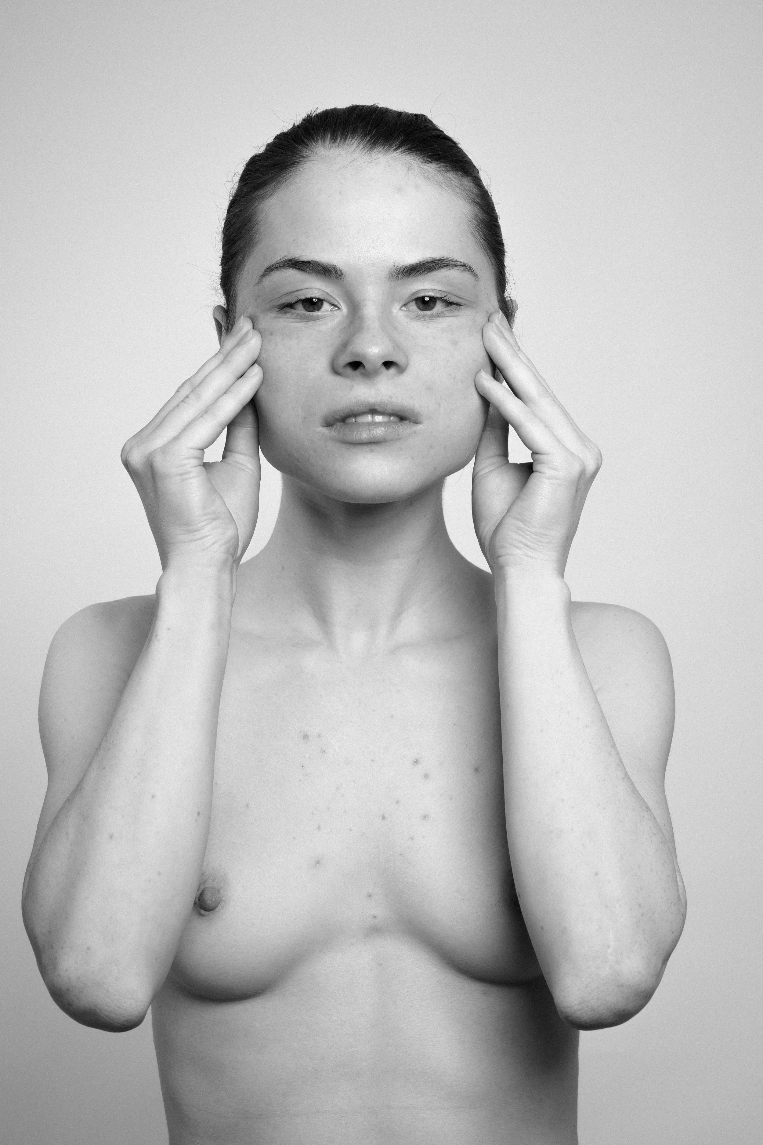 Studio portrait of a young woman in black and white. She manipulates her face, stretches her skin, with her both hands, makes faces, grimaces.