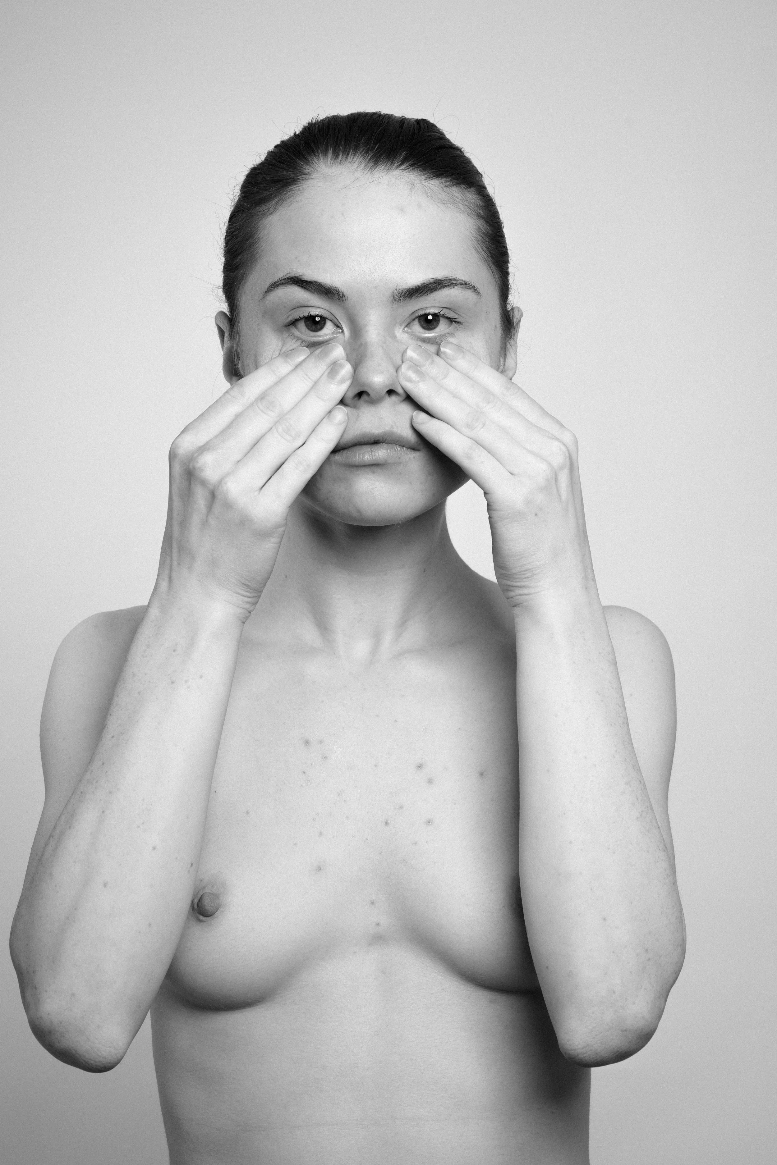 Studio portrait of a young woman in black and white. She manipulates her face, stretches her skin, with her both hands, makes faces, grimaces.