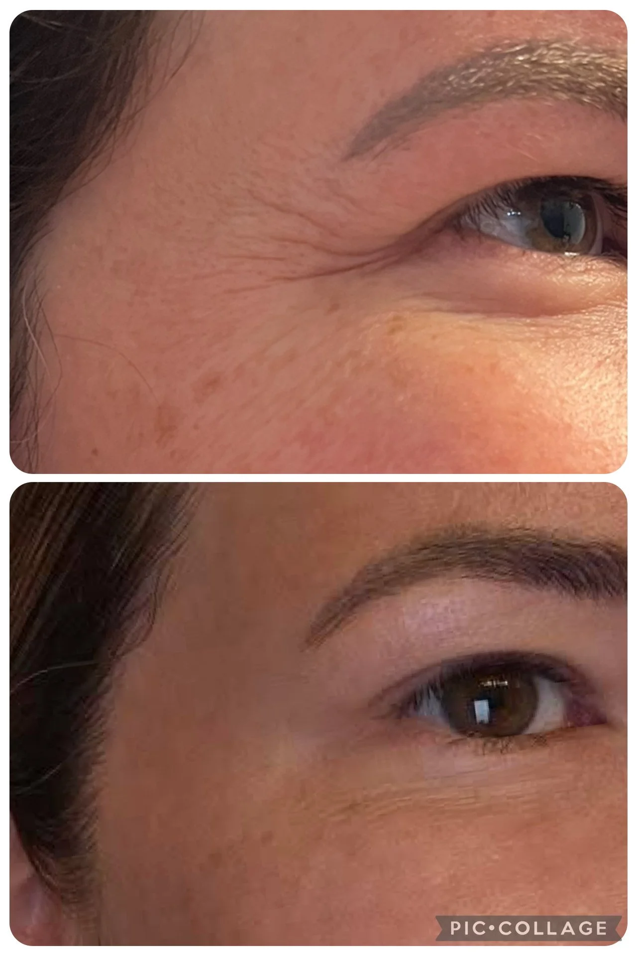 A side-by-side comparison of a person's eye area before and after applying skincare or treatment, showing reduced wrinkles and smoother skin around the eyes.