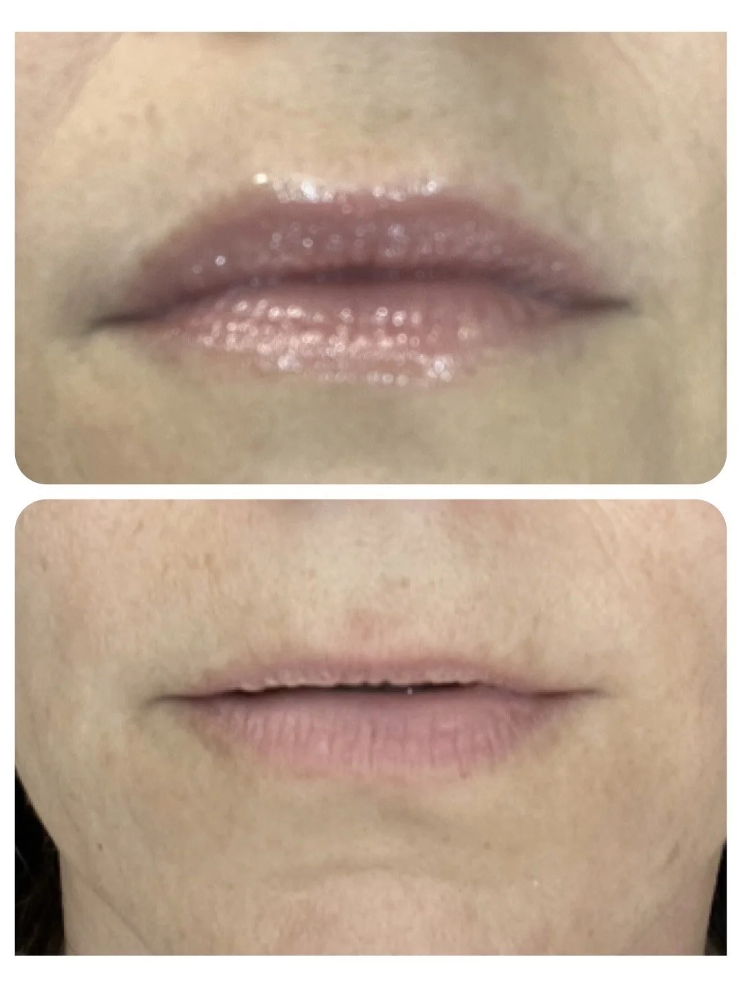 Comparison of lips before and after makeup or treatment, with the top showing lips with gloss and the bottom showing natural, matte lips.