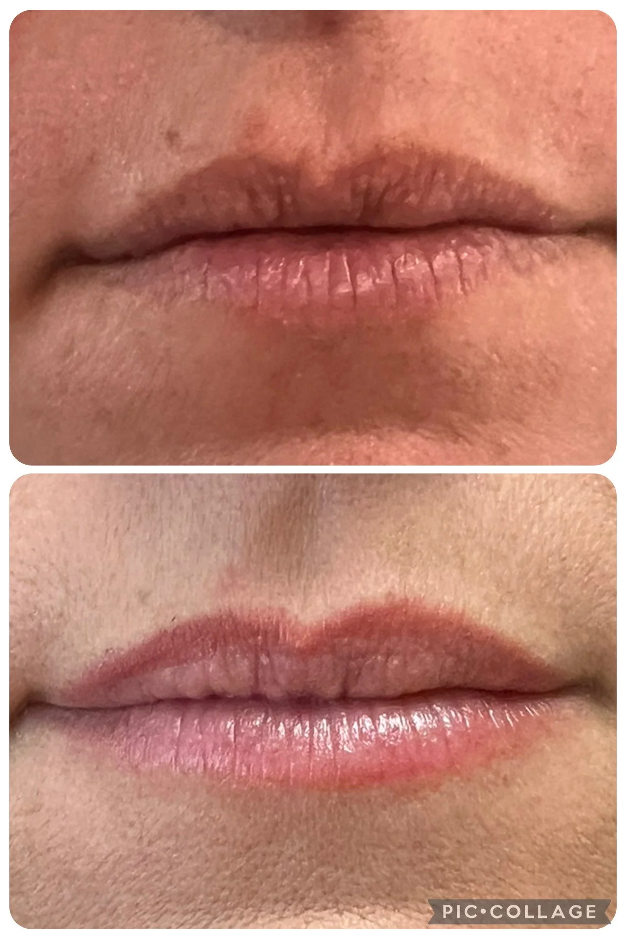 Close-up of a person's lips before and after lip makeup application, showing natural lips in the top image and with enhanced lipstick in the bottom image.
