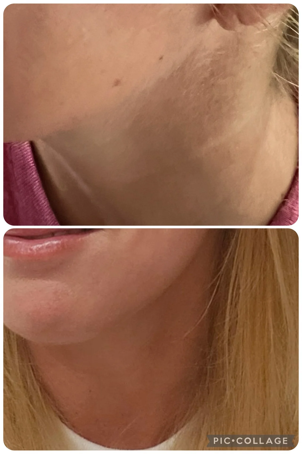 A side-by-side comparison of a person's skin before and after skincare, showing clear, smooth skin with improved texture in the 'after' image.