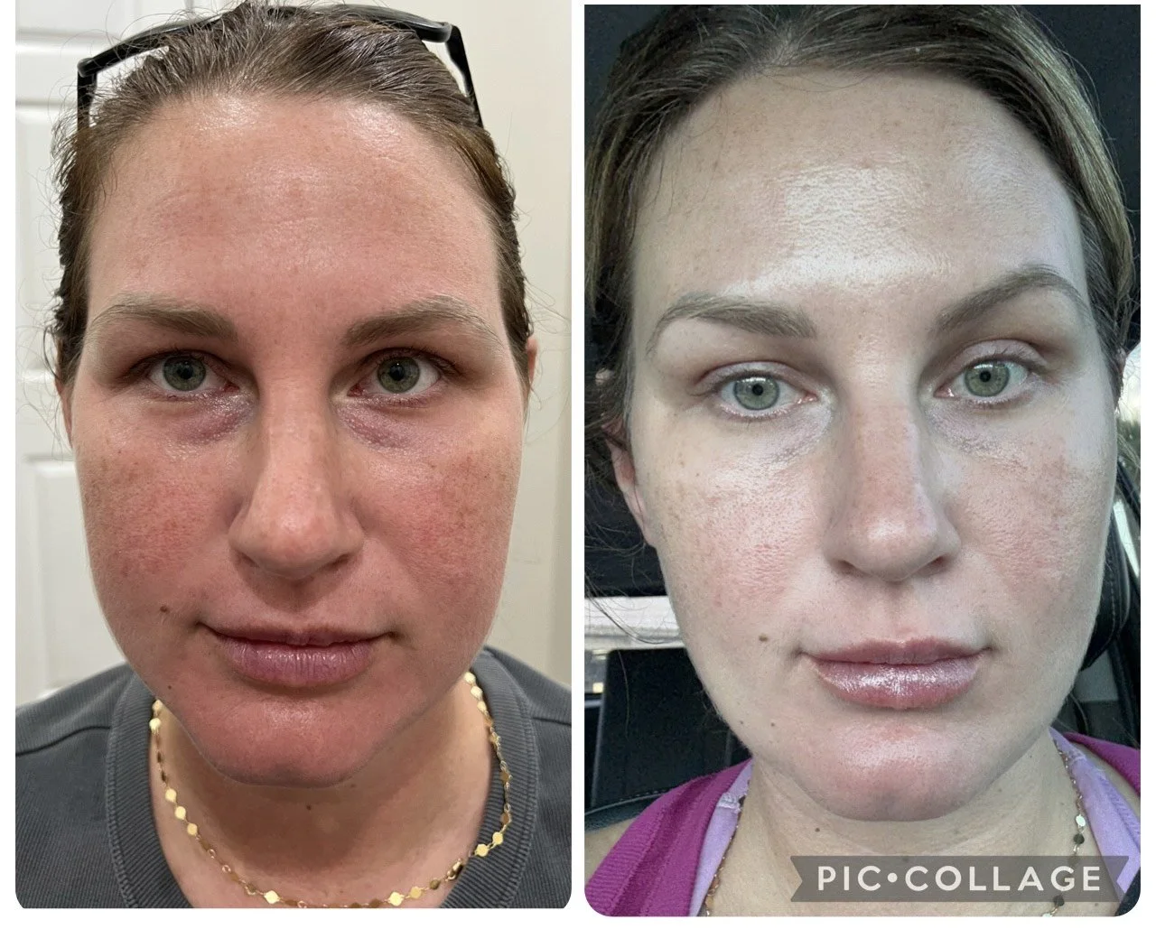 Side-by-side comparison of a woman before and after skincare or makeup, showing improved skin clarity and tone on the right.