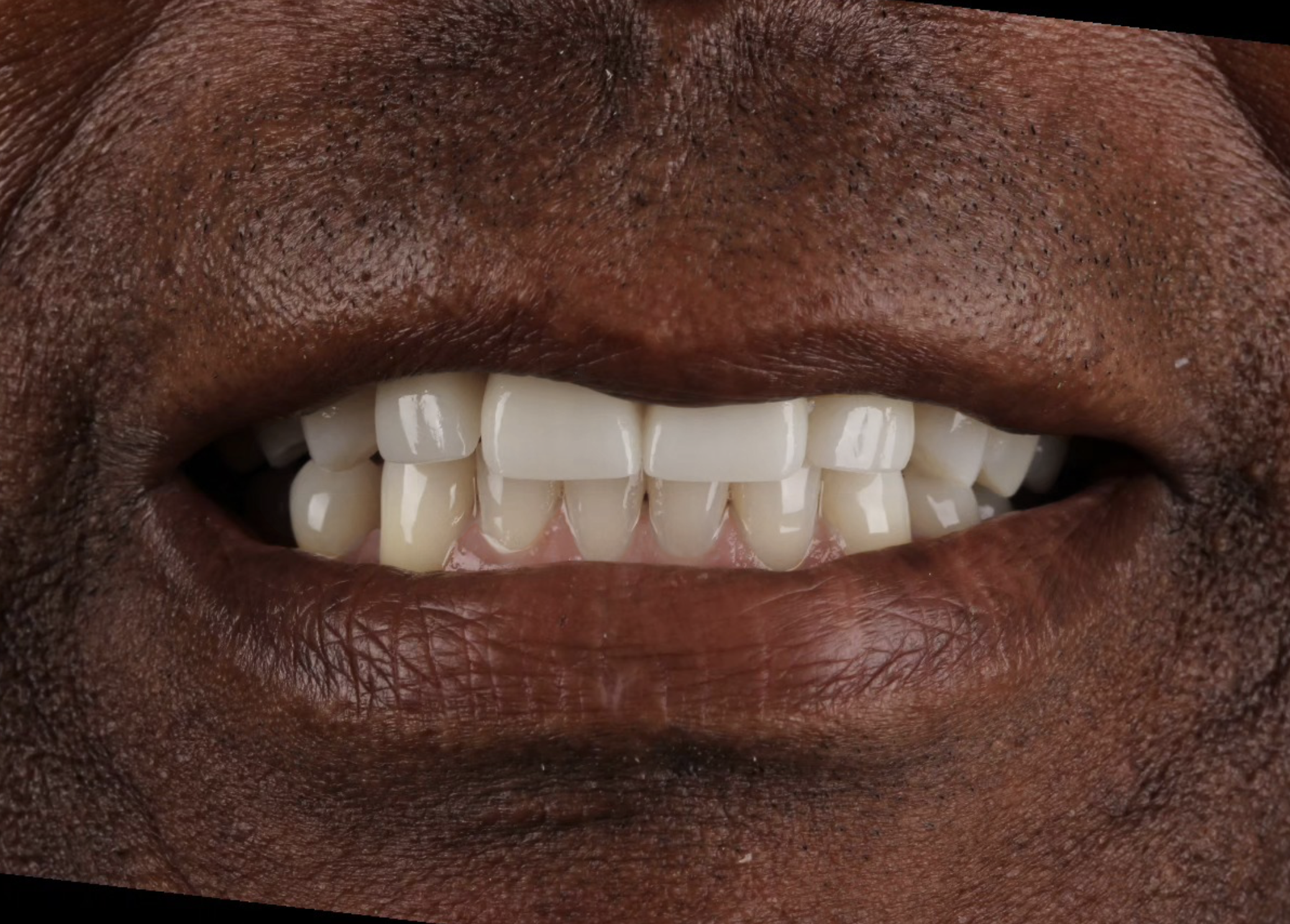 Photo of a smile with beautiful teeth