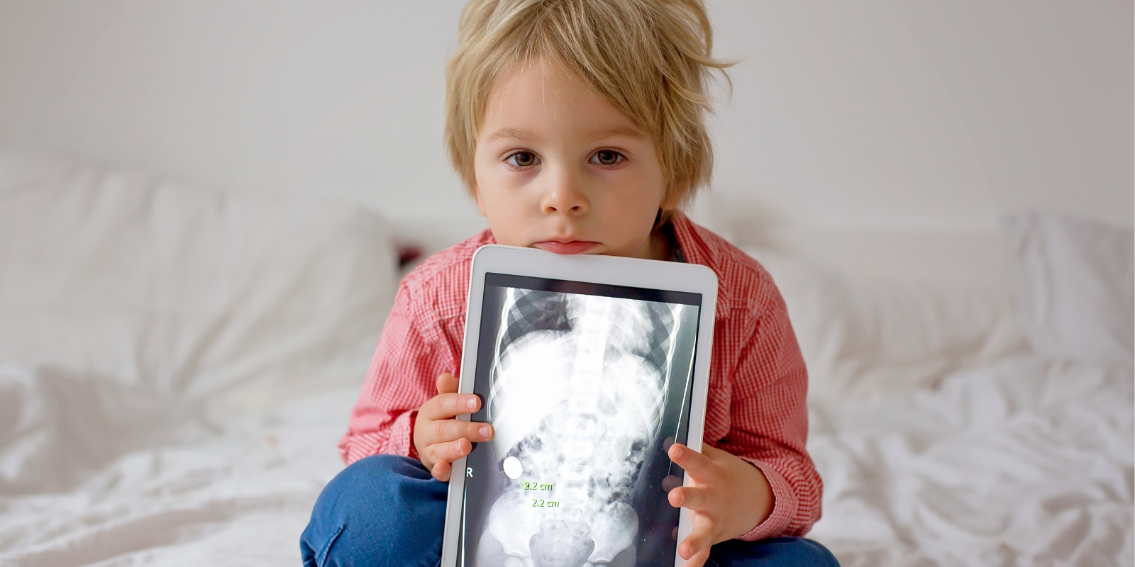 Extreme Picky Eating or Eosinophilic Oesophagitis?