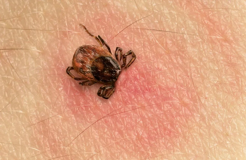 What’s Lyme Got To Do With It?