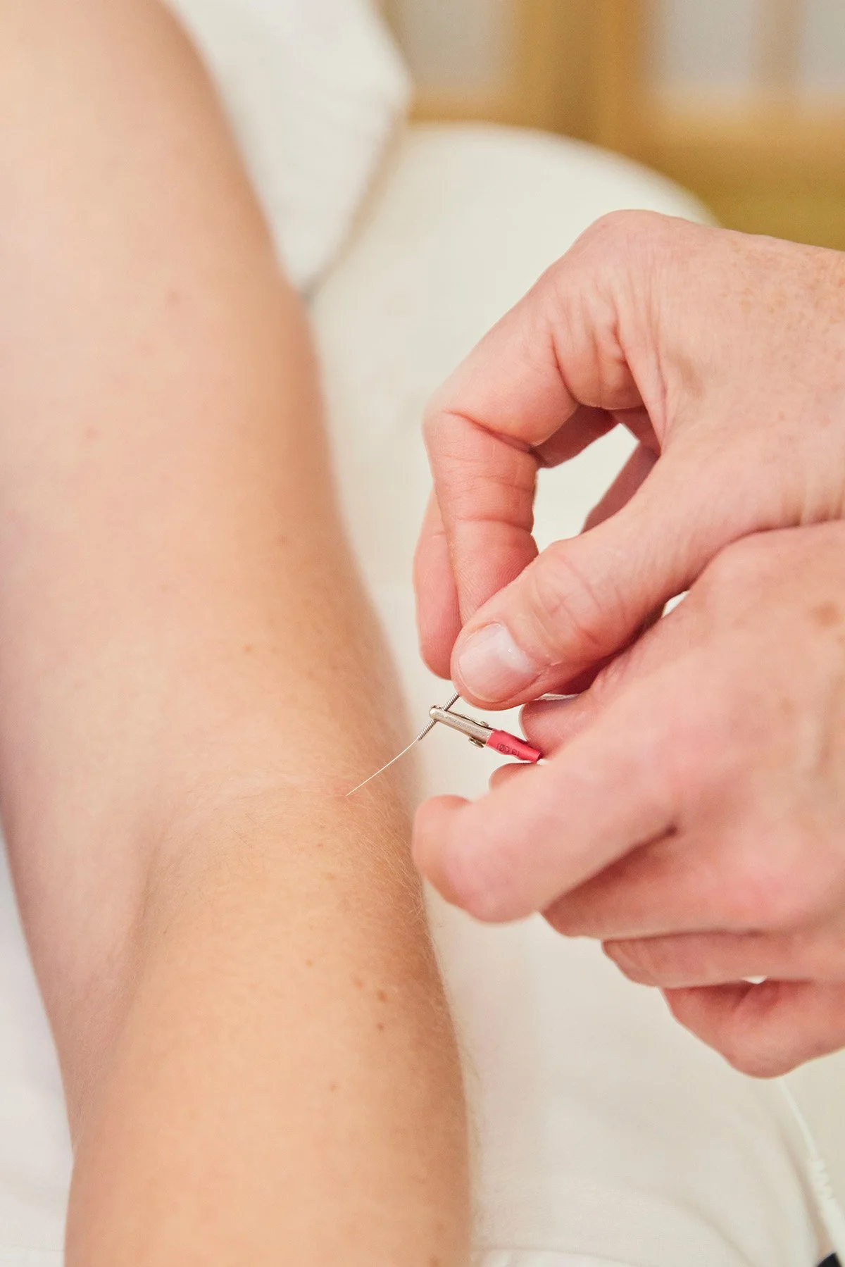 The Acupuncture - A Okay Wellness