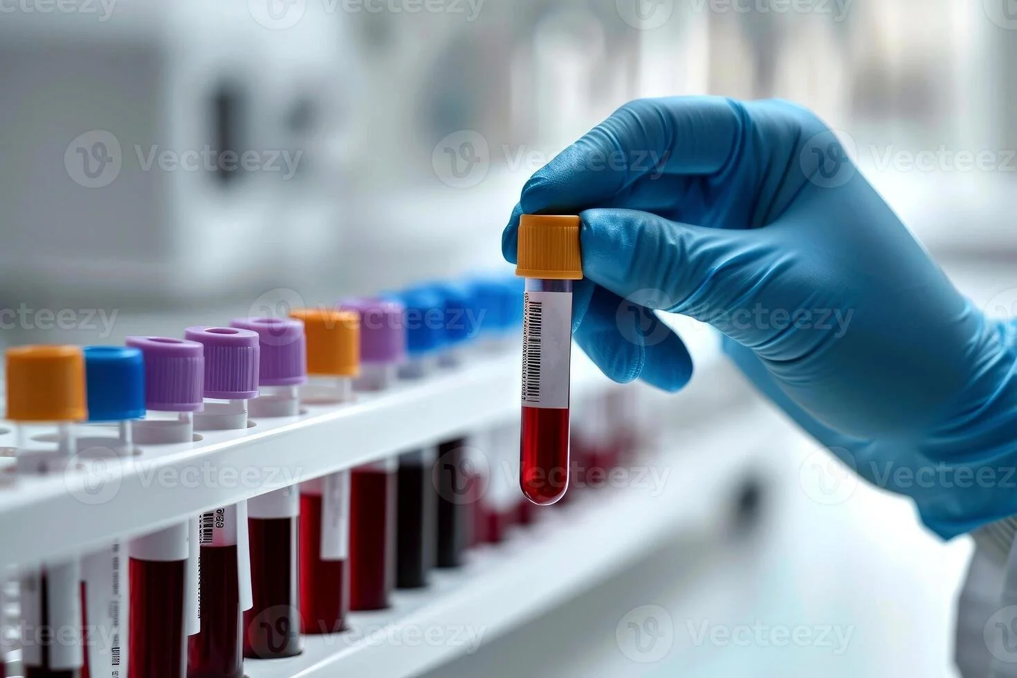 Metabolic Lab Review