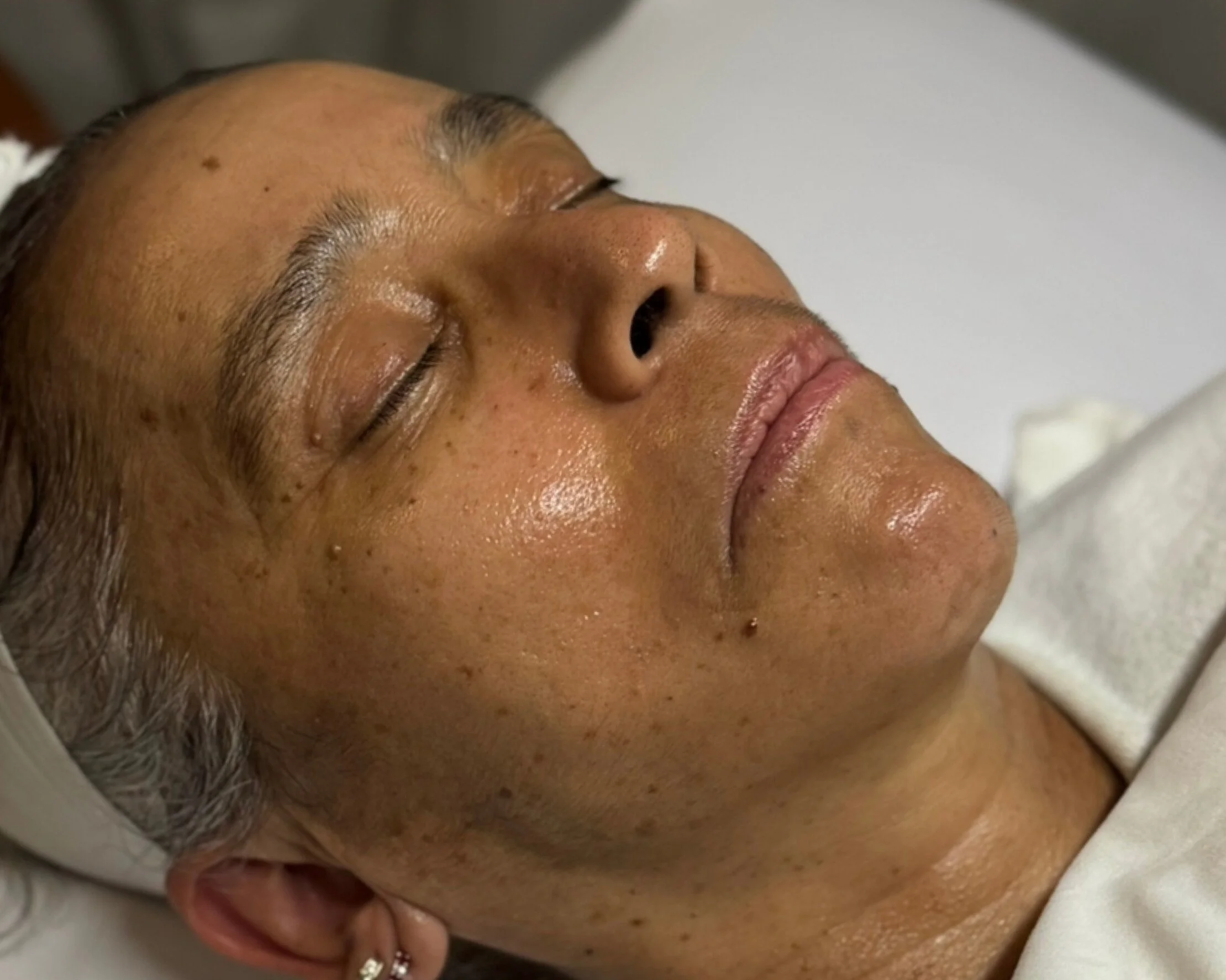 Aging Gracefully: A Holistic Approach Beyond Botox