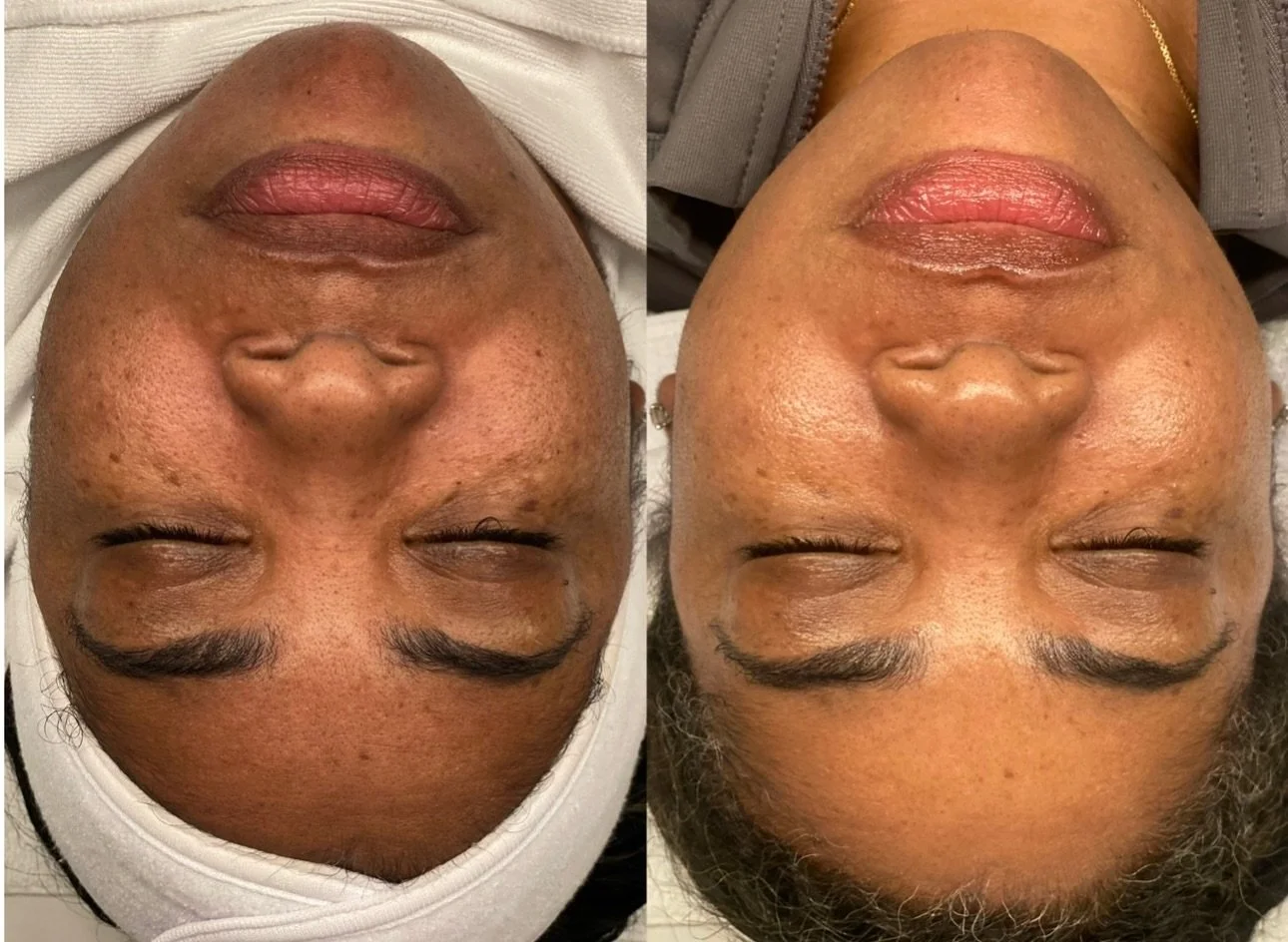 This might seem small, but one thing has remained constant over my last 18 years as an esthetician: if you want to achieve optimal results with corrective skincare treatments, this is the season to do it. ✨

Fall and winter are prime time for correct