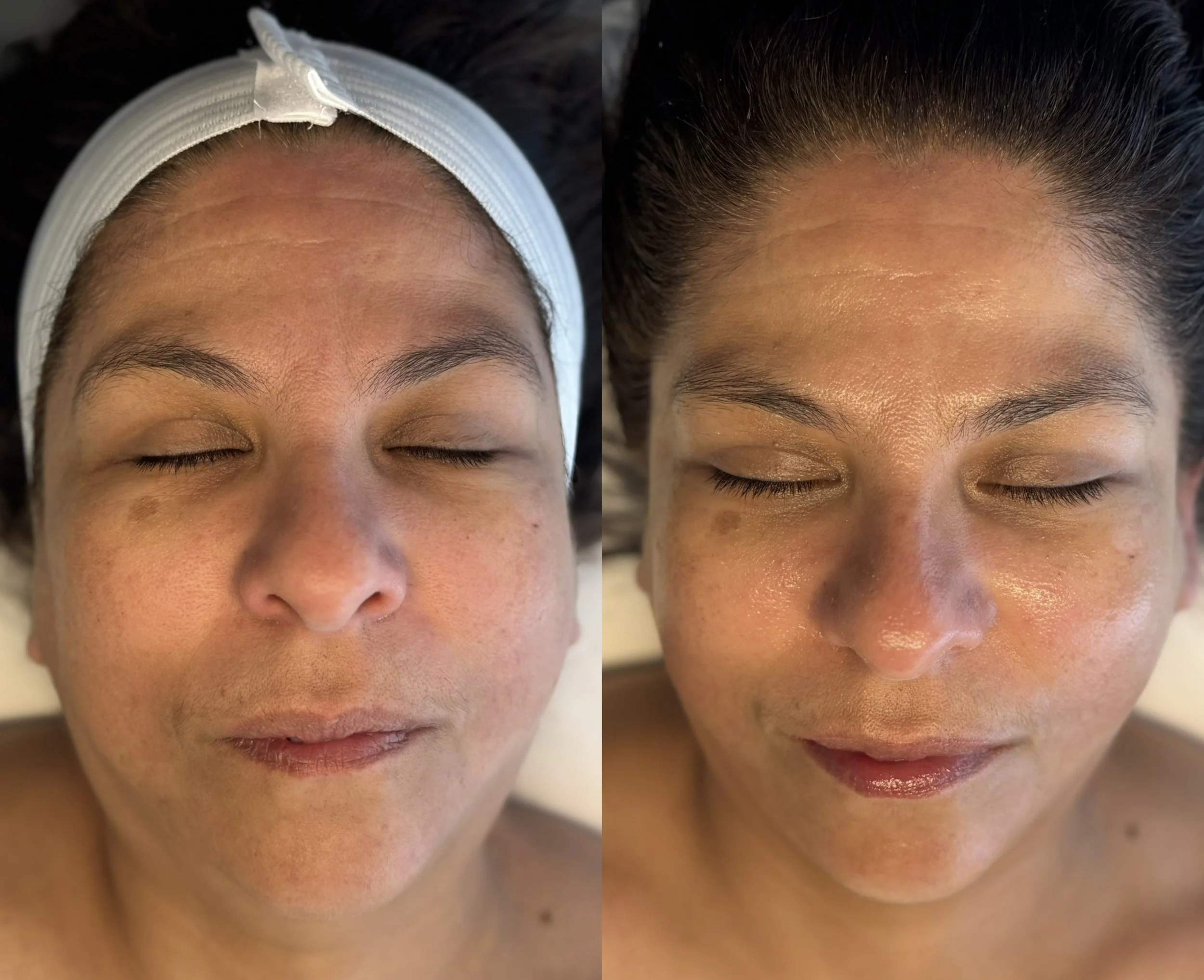 Lymphatic Drainage Massage: The Trending Wellness Ritual With Timeless Roots