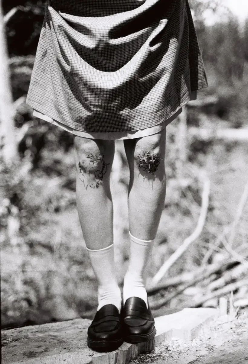 Black-and-white photo of a child in a plaid skirt, knee socks, and loafers, standing with grass and burrs stuck to both knees.