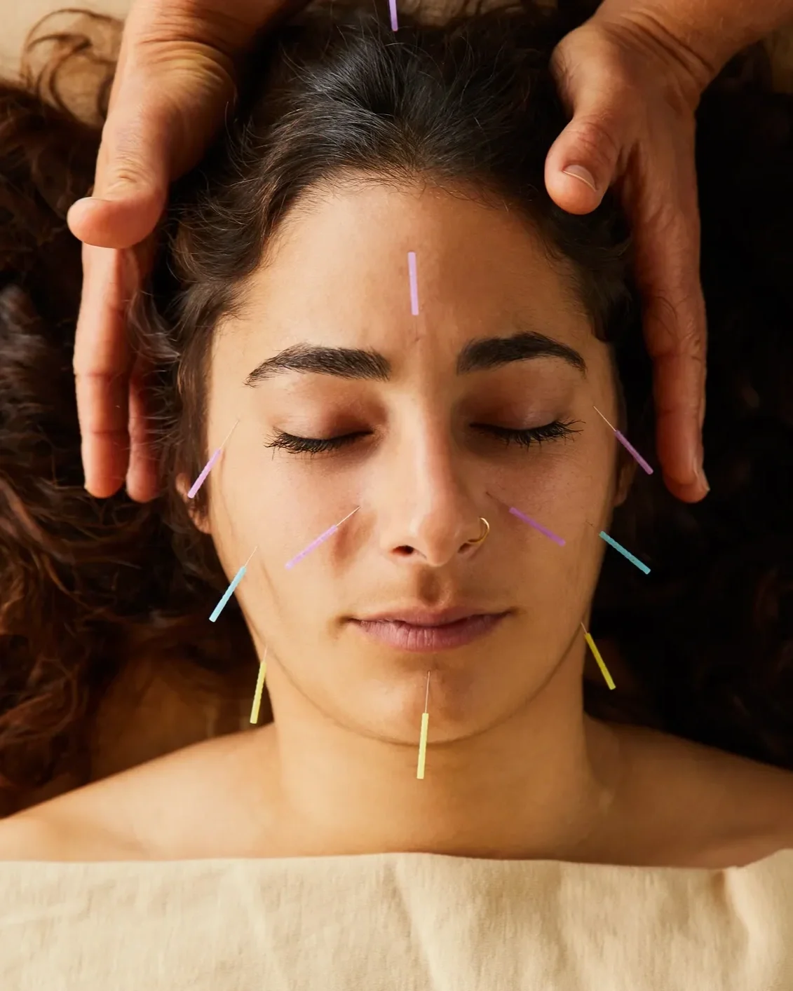 cosmetic+acupuncture.webp