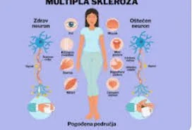 Sveobuhvatni vodič za ishranu i dijetu za pacijente sa multiplom sklerozom