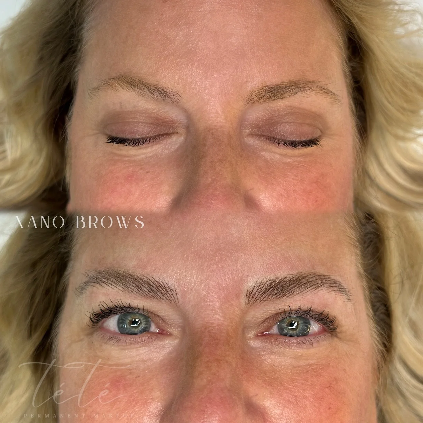 Fuller brows ✨

&mdash;&mdash;&mdash;&mdash;&mdash;&mdash;&mdash;&mdash;&mdash;&mdash;&mdash;&mdash;&mdash;&mdash;&mdash;&mdash;&mdash;&mdash;&mdash;&mdash;&mdash;&mdash;-
Service: Nano Brows
Lasts: 1&ndash;3 years
Pain is minimal to none &ndash; num