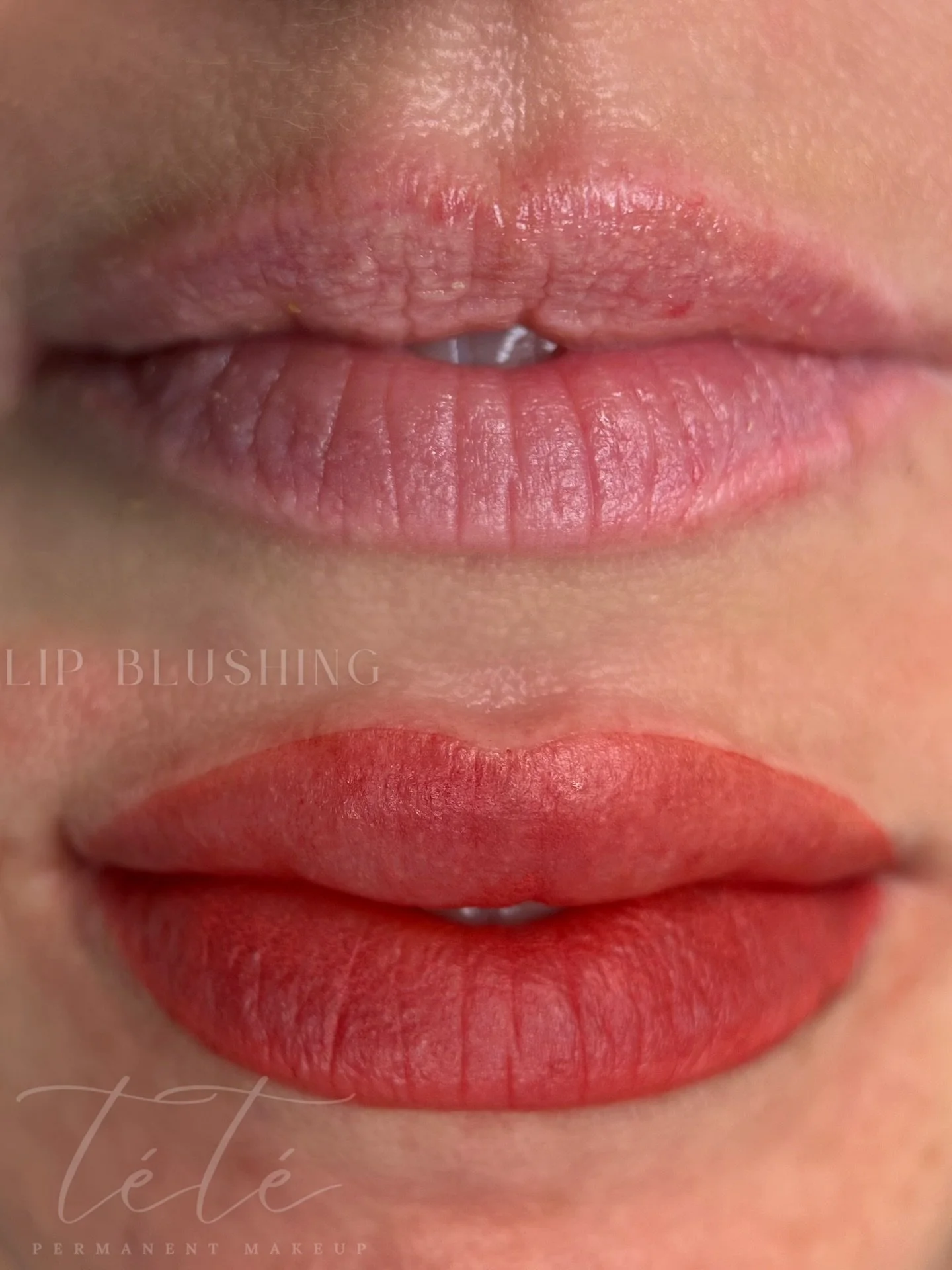 We focused on bringing more color to the borders to give her lips a fuller, more even look💋
The initial swelling will go down over the next day or so, and the color will soften as they heal🫶🏽

&mdash;&mdash;&mdash;&mdash;&mdash;&mdash;&mdash;&mdas