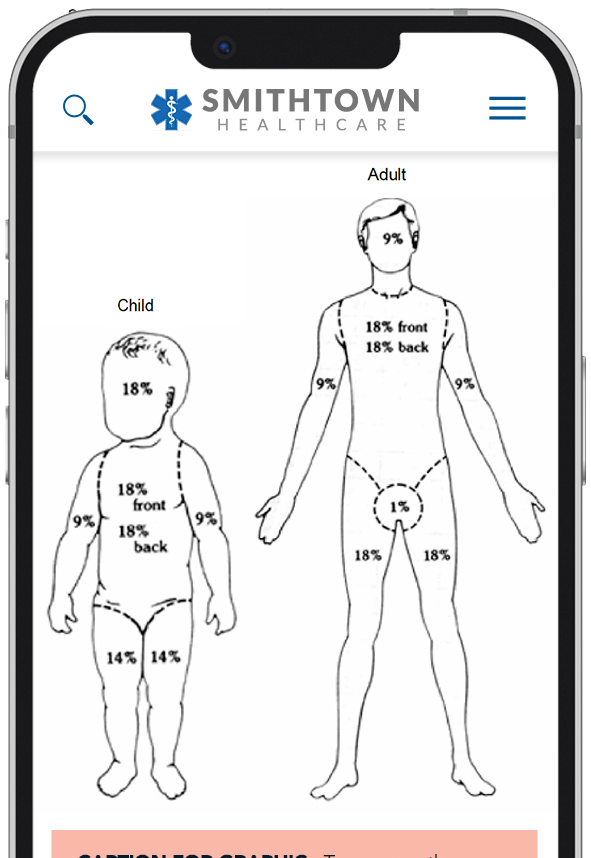 iPhone-Views-Burns-Graphic-9-3-25.png